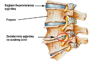Qığırdaq toxuması